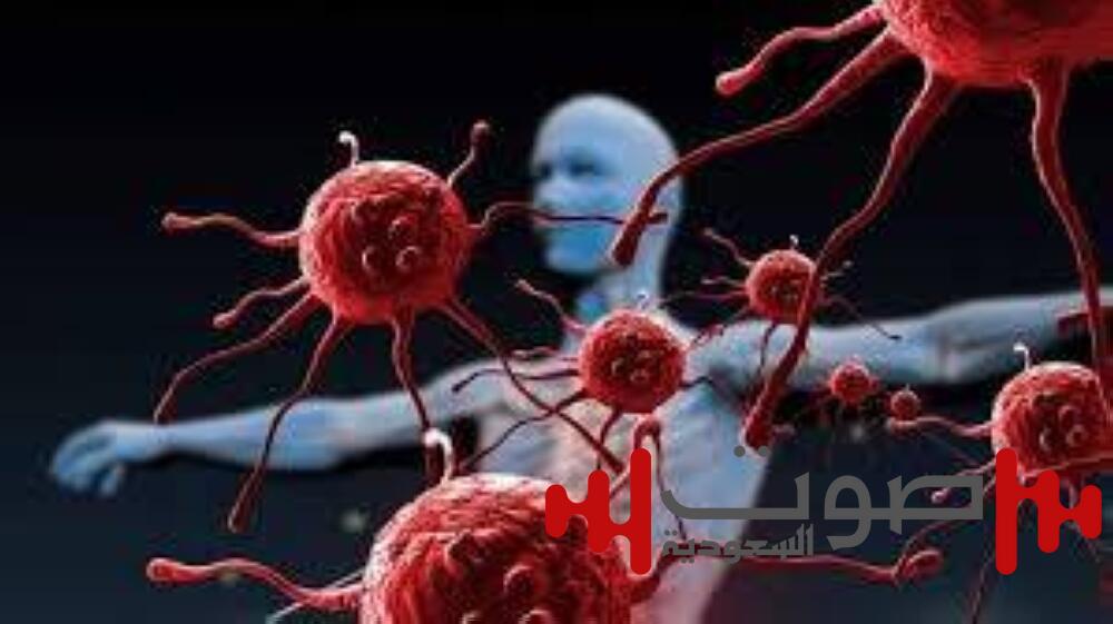 5 علامات للشامات تثير شبهة السرطان