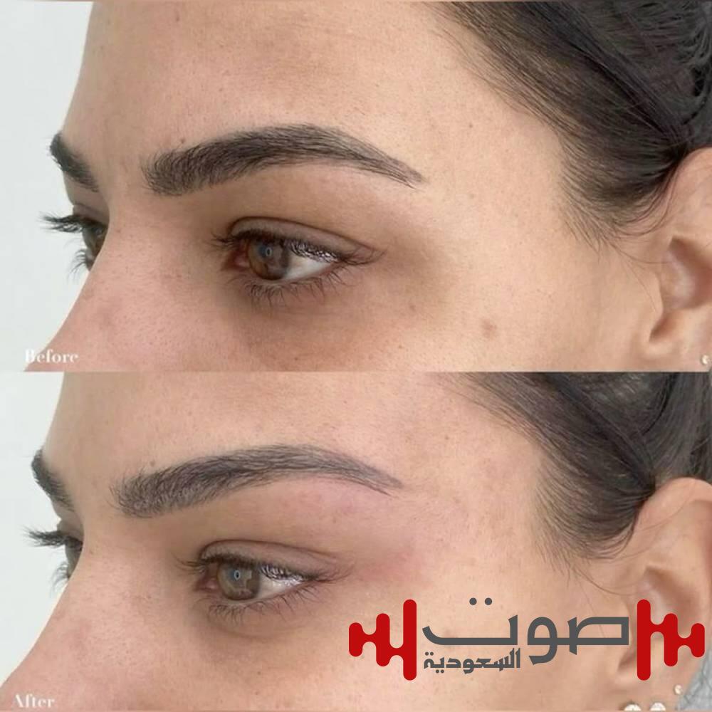 شد العيون.. بين الجاذبية البصرية والمخاطر المحتملة