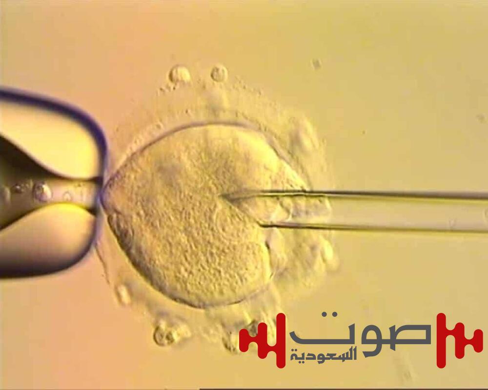 تقنية جديدة تمنع انتقال الأمراض الوراثية للأطفال