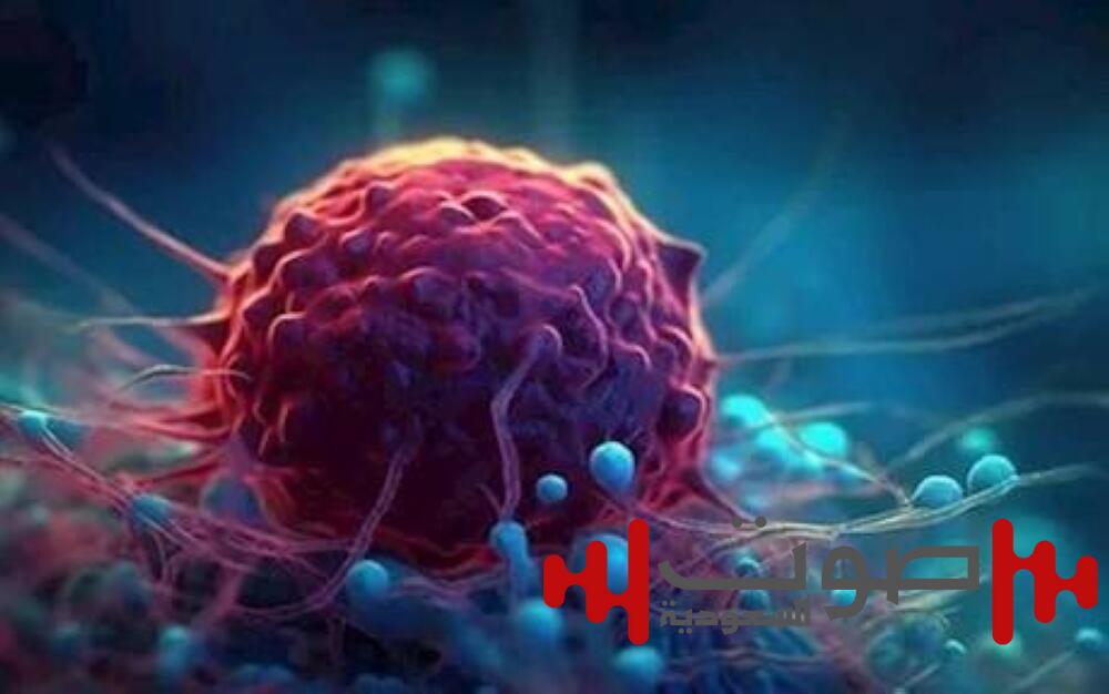 تقنية جديدة في اختبار تشخيص سرطان البروستات