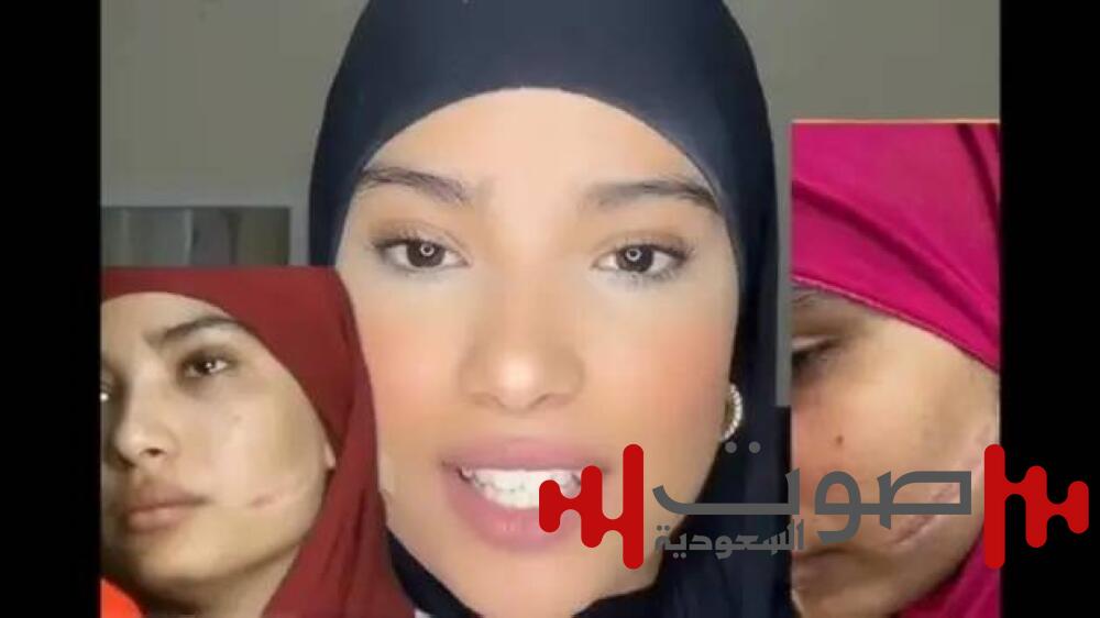 بعد تشويه وجهها.. تهديد جديد يعيد قضية سلمى المغربية إلى الواجهة