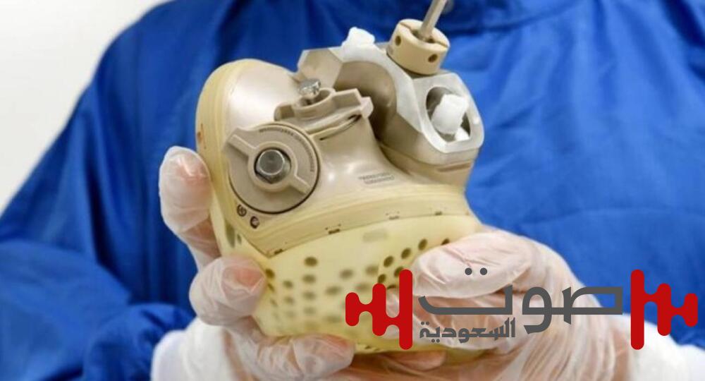 عاش 100 يوم.. مريض يغادر المستشفى بقلب اصطناعي!