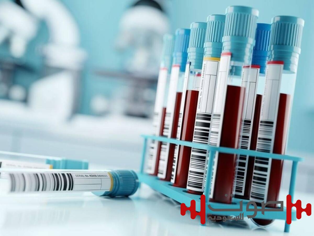 فحص دم يكشف عن سرطان المبيض في مراحله المبكرة