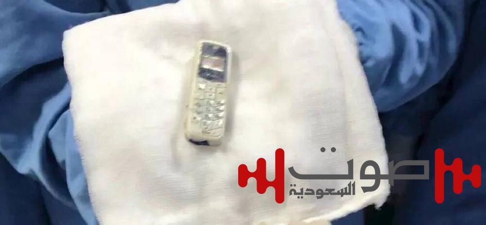 ظل ملفوفاً داخل كيس لـ 6 أعوام.. استخراج جوال من معدة سجين