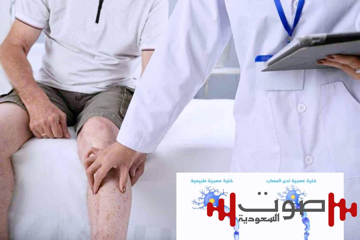 التصلب الضموري.. ارتبط تاريخياً ببعض اللاعبين