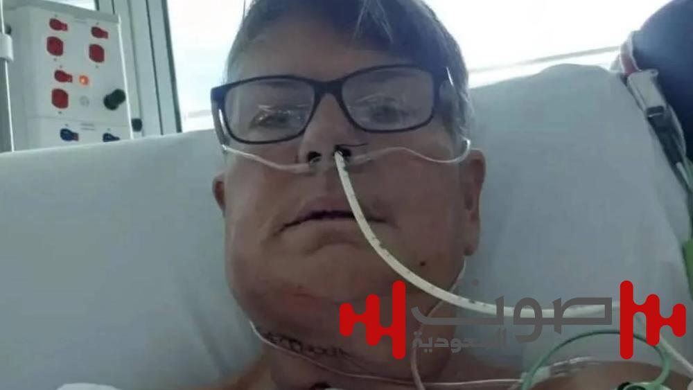 على طريقة «اللي بالي بالك».. جراحة نادرة تحول امرأة أسترالية إلى إنجليزية !