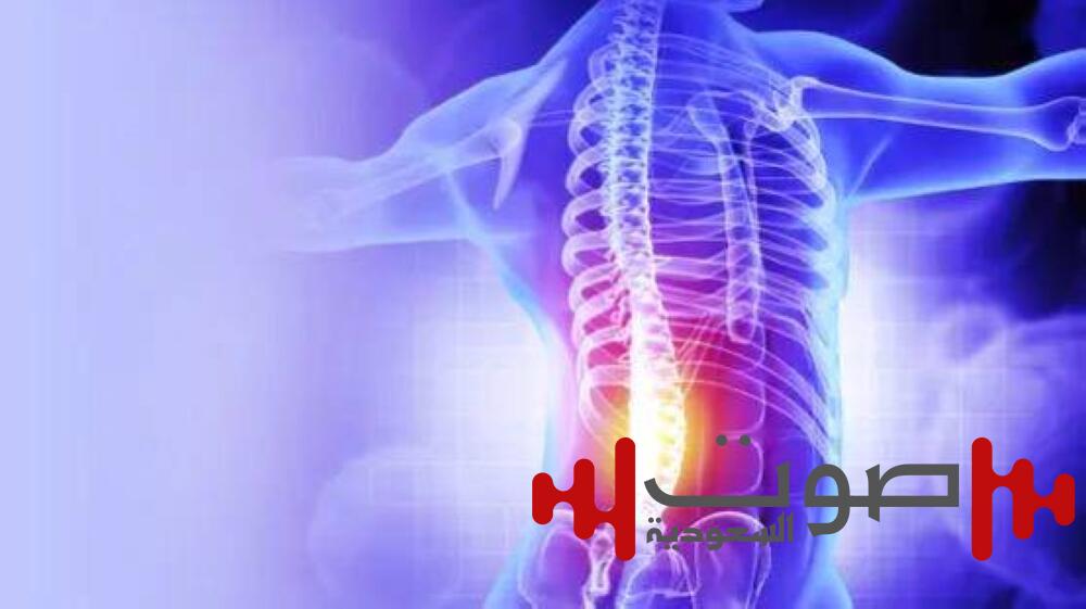 زرع أنسجة بشرية لتخفيف آلام الظهر المزمنة دون جراحة