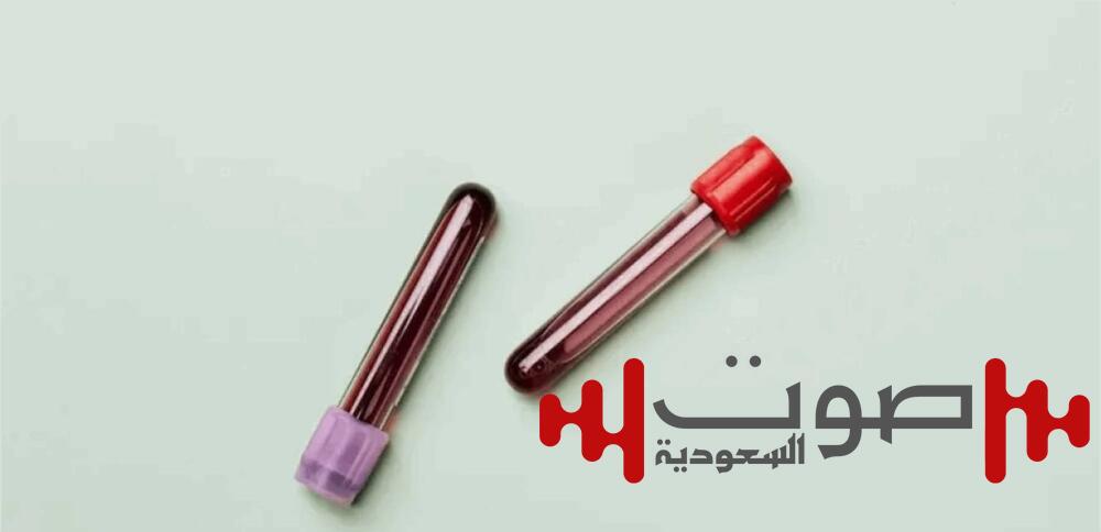 امرأة تحمل فئة دم جديدة فريدة عالمياً