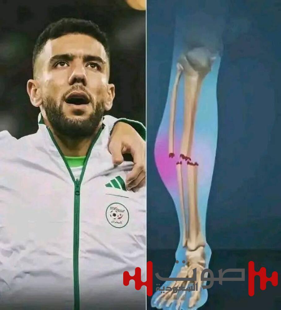 بعد إصابته المروعة.. «عكاظ» تكشف تفاصيل الحالة الصحية للاعب «قندوسي»