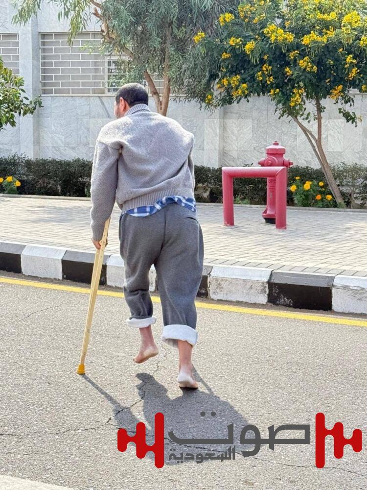 عيادات مستشفى المدينة بلا أشعة.. «الصحة» لـ«عكاظ»: توجد «متنقلة» و«غولف كار»