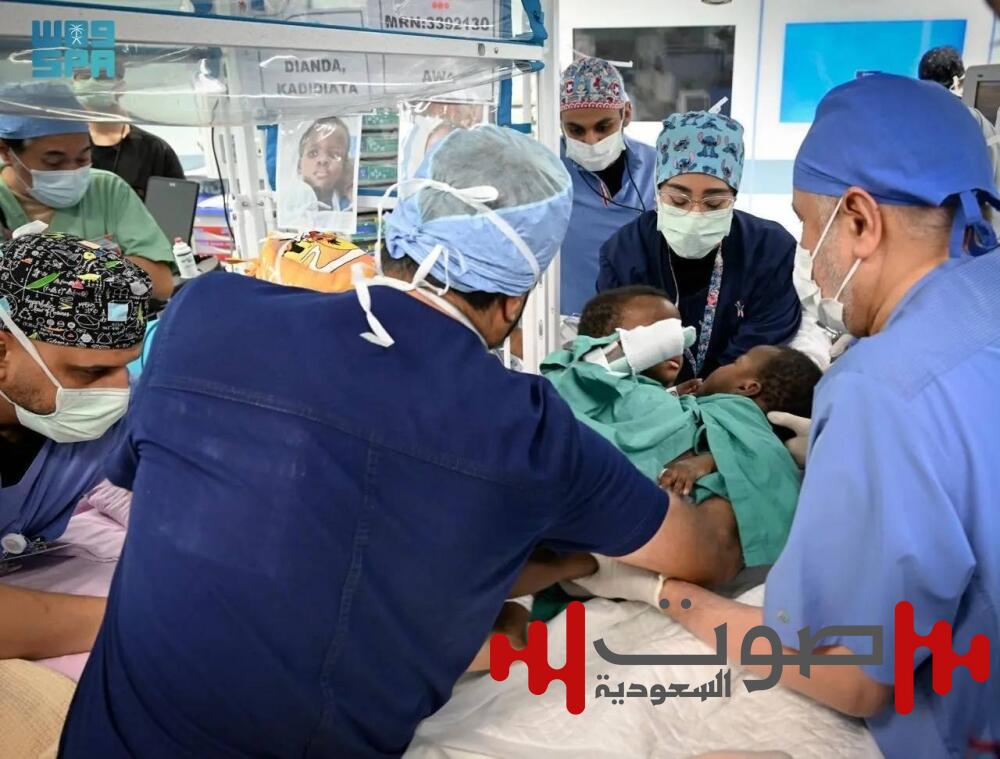 بدء عملية فصل البوركيني «حوى وخديجة».. برنامج «التوائم الملتصقة» اعتنى بـ 146 توأماً سيامياً من 27 دولة