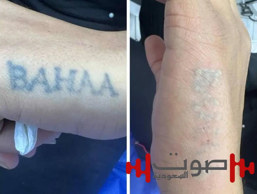 إندونيسيا تزيل أوشامها في رمضان.. خدمة مجانية تجذب المشاهير