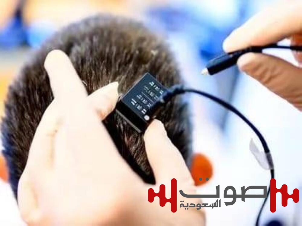 ثورة علمية.. شريحة دماغية تترجم الأفكار إلى كلام منطوق في ثوانٍ