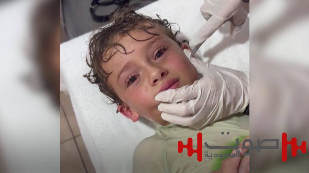 سلطعون حي يختبئ داخل أذن طفل بالمكسيك!